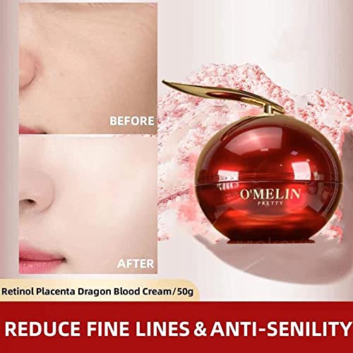 Retinol Longxue Creme, Retinol Dragons Creme de clareamento de sangue, creme de creme de leite de omelin, creme sanguíneo