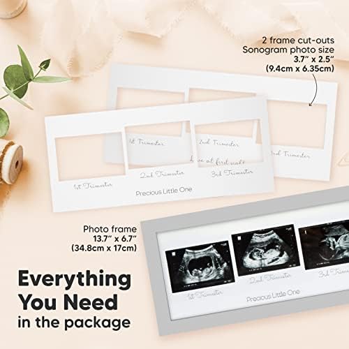 Sonograma Picture Frame - Trio Ultrassom Picture Frames for Mom Be Gift - Baby Ultrassom Frame - Anúncios de gravidez Sonogram