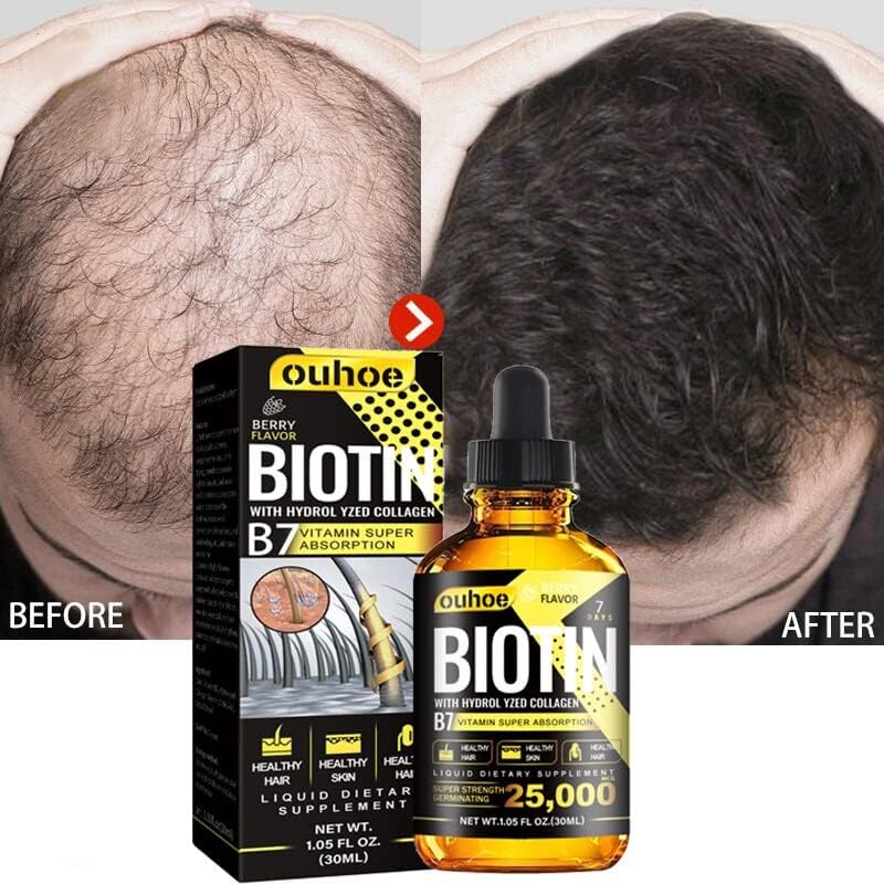 Biotin Hair Growth Serum Anti -Perda de cabelo Produtos de cabelo rápido Cuidado com cabelo